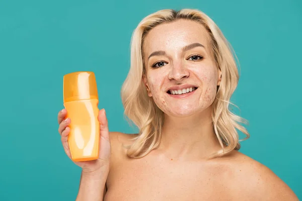 Mujer alegre con botella de retención de acné con protector solar aislado en turquesa - foto de stock