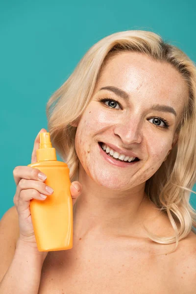 Mujer feliz con acné adulto sosteniendo botella con protector solar aislado en turquesa - foto de stock