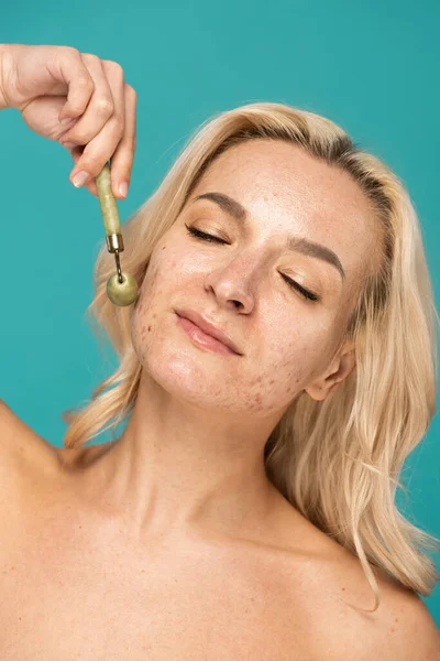 Blonde woman with closed eyes and acne using jade roller isolated on turquoise — Stock Photo