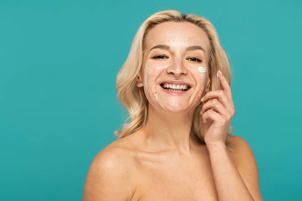 Happy blonde woman with acne applying cream on face isolated on turquoise — Stock Photo