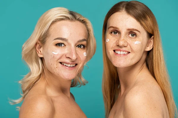 Mulheres alegres com diferentes condições de pele e creme em rostos olhando para a câmera isolada em turquesa — Fotografia de Stock