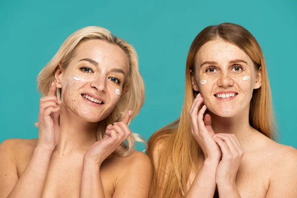 Mujeres alegres con diferentes condiciones de la piel aplicando crema en las caras mientras mira la cámara aislada en turquesa - foto de stock