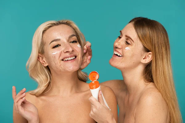Femme gaie avec des taches de rousseur appliquer de la crème sur le visage d'un ami avec l'acné isolé sur turquoise — Photo de stock