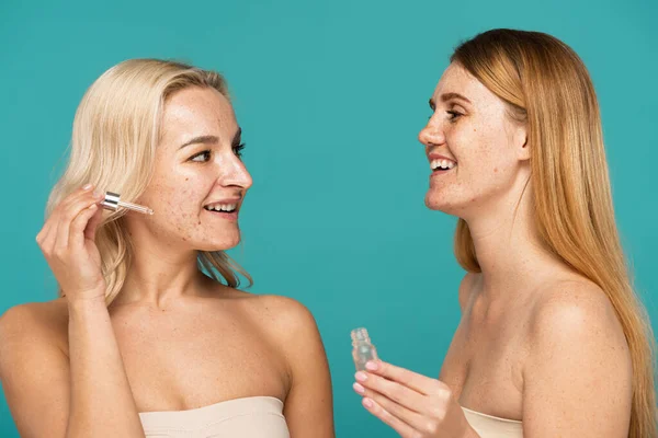 Freckled woman smiling while holding serum near blonde friend with acne isolated on turquoise — Stock Photo