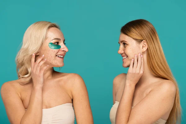 Blonde woman with acne and eye patches smiling while looking at freckled friend isolated on turquoise — Stock Photo