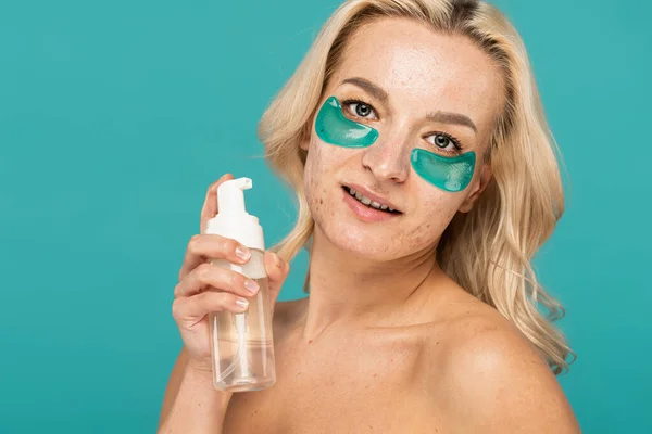 Mujer rubia con acné y parches para los ojos hidratantes sosteniendo botella con limpiador de espuma aislado en turquesa - foto de stock