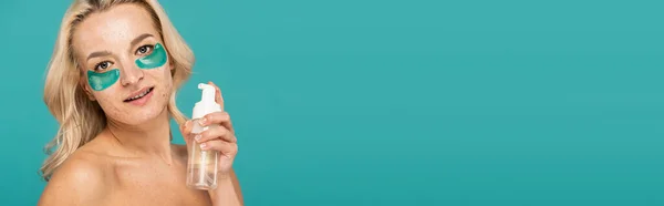 Femme blonde avec acné et patchs pour les yeux tenant bouteille avec nettoyant mousse isolé sur turquoise, bannière — Photo de stock