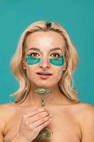 Blonde woman with acne and moisturizing eye patches holding jade roller isolated on turquoise — Stock Photo