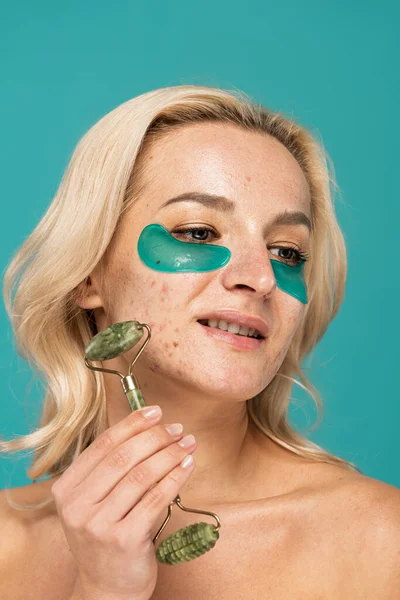 Mulher loira com imperfeição na pele e manchas olho hidratante segurando rolo de jade isolado em turquesa — Fotografia de Stock