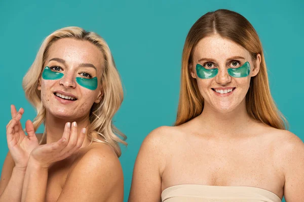 Happy women with different skin conditions and patches under eyes smiling isolated on turquoise — Stock Photo