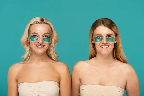 Femmes joyeuses avec différentes affections de la peau et des patchs oculaires posant isolées sur turquoise — Photo de stock