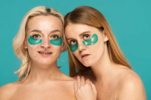 Mujeres jóvenes con diferentes afecciones de la piel y parches oculares posando aisladas en turquesa - foto de stock