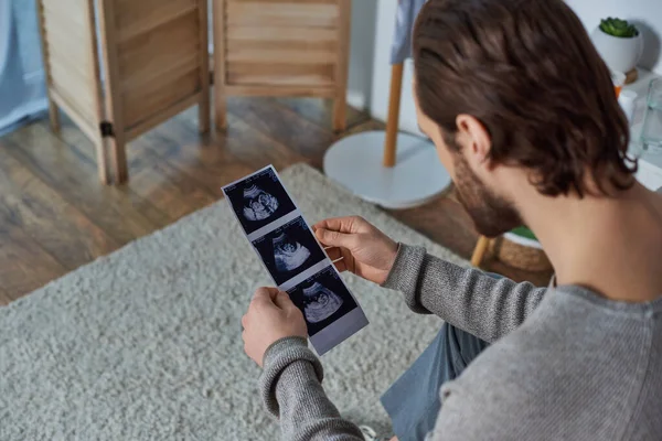 Bearded man holding ultrasound photo, sitting on bed, pregnancy, responsibility, future father — Stock Photo