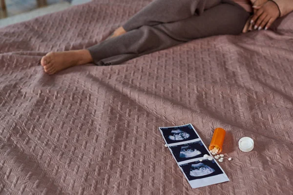 Pílulas de controle de natalidade perto de ultra-som foto, mulher americana africana na cama, tomada de decisão, cortada — Fotografia de Stock