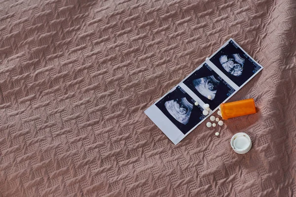 Vista superior del biberón con pastillas, ultrasonido, feto, control de natalidad, dormitorio, concepto de aborto - foto de stock