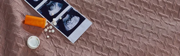 Vista dall'alto del flacone con pillole, ultrasuoni, nascituro, contraccezione, concetto di aborto, banner — Foto stock