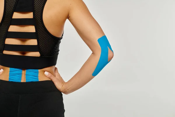 Cropped view of young woman with arms akimbo in black sport wear with kinesiological tapes on body — Stock Photo