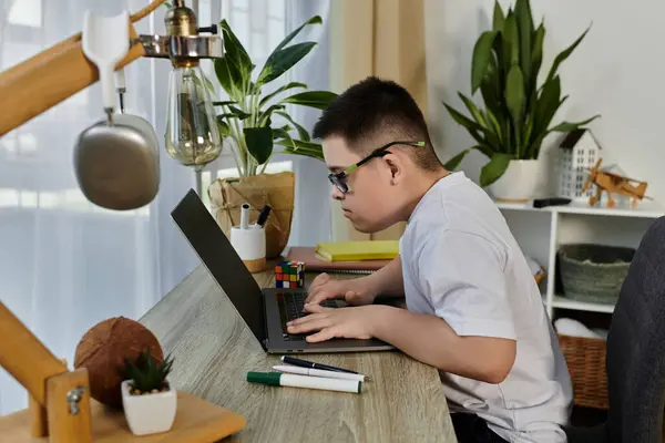 A young boy with Down syndrome uses a laptop at home. — Stock Photo