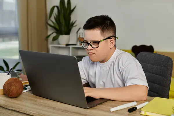 Un ragazzo con la sindrome di Down si siede alla scrivania, usando un computer portatile. — Foto stock