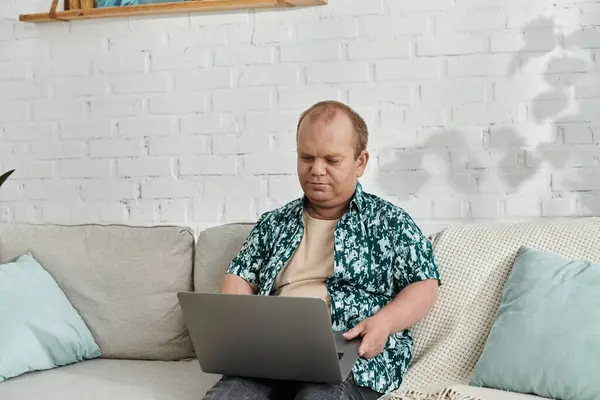 A man with inclusivity sits on a couch using a laptop. — Stock Photo