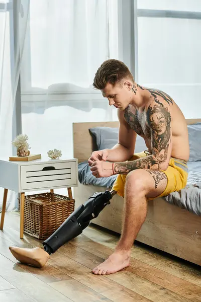 A young man sits on the edge of a bed, contemplating his journey with a prosthetic leg. — Stock Photo