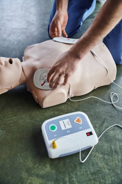 Kalp canlandırma teknikleri, kalp masajı manikürüne defibrilatör uygulayan profesyonel sağlık görevlilerinin kısmi görüşü, yüksek açılı görüş, sağlık hizmeti ve hayat kurtarma teknikleri kavramı.