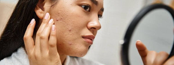 young asian woman with brunette hair and pimples looking at her face in mirror, skin issues banner