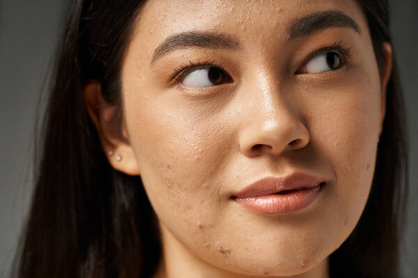 young asian woman with brunette hair and acne prone skin looking at mirror in bathroom, banner