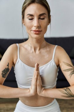 Vitiligo 'su olan genç bir kadın modern dairesinde yoga yapıyor. Meditasyon ve farkındalık yoluyla iç huzurunu buluyor..