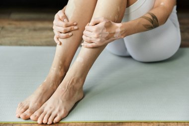 Vitiligo 'su olan genç bir kadın modern bir dairede yoga minderinde oturuyor, bacakları çapraz ve elleri bacağında dinleniyor..