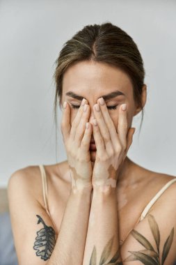 A young woman with vitiligo and tattoos sits in her cozy bedroom, lost in thought as she rests her head in her hands. clipart