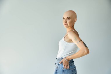 Alopecia 'lı genç bir kadın gururla duruyor, eşsiz güzelliğini sergiliyor..