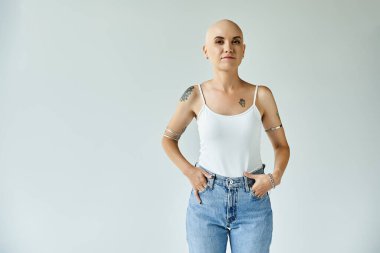 Alopecia 'lı genç bir kadın gururla ayakta duruyor. Kıyafeti, kendine güvenini ve tarzını yansıtıyor..