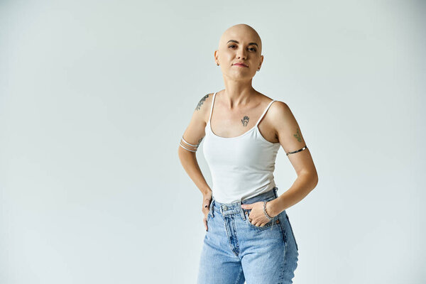 Молодая женщина гордо обнимает свою лысину, демонстрируя свою неповторимую красоту в стильном наряде.