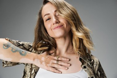 Vitiligo gülüşlü, kendine güvenen genç bir kadın, eşsiz tarzını ve özelliklerini sergiliyor..