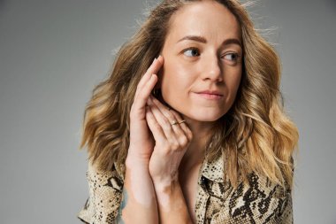Genç kadın, özgüven ve güzelliği vitiligo ile gösteriyor, benzersizliği ve zarafeti vurguluyor.