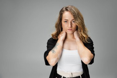 Vitiligo 'su olan genç bir kadın, tarafsız gri bir arkaplanda poz verirken güzelliğini sergiliyor..