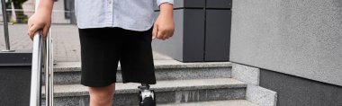 Genç ve yakışıklı bir adam protez bacakla merdivenlerde geziniyor. Kararlılık ve stil gösteriyor..
