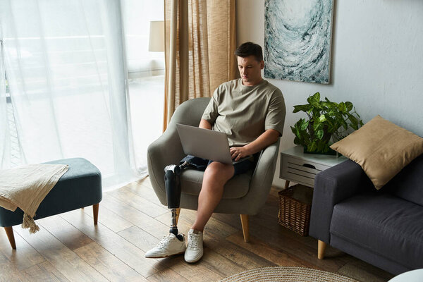 Handsome young man with a prosthetic leg sits on a chair using a laptop in a relaxed setting.