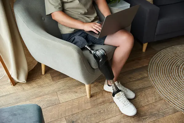 Protez bacaklı yakışıklı genç adam rahat bir yaşam alanında dizüstü bilgisayarda oturuyor.