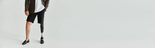 Молодой человек стоит со стилем, подчеркивая свою протезную ногу, одеваясь непринужденно.