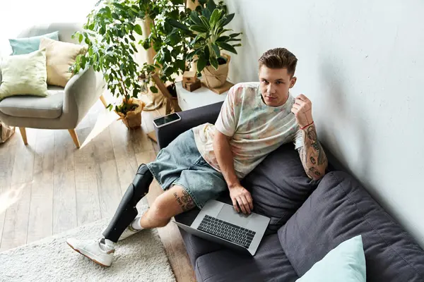 Protez bacaklı genç adam evde dinlenirken laptopuyla işe koyuluyor..