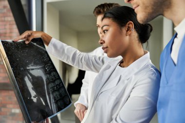 Three healthcare professionals discuss patient x-ray scans in a contemporary hospital environment.