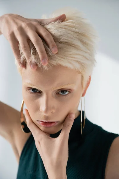 Junges Albino-Model mit hellhäutigem Gesicht, das Hände berührt, während es auf grau posiert — Stockfoto