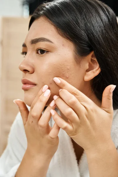 Junge asiatische Frau mit brünetten Haaren untersucht ihre Haut mit Akne im Badezimmerspiegel, vertikal — Stockfoto