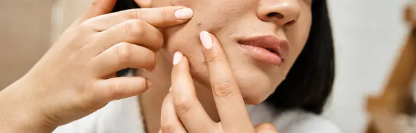 Bannière de recadrée asiatique femme en peignoir popping bouton sur son visage, problèmes de peau ou de vraies personnes — Photo de stock