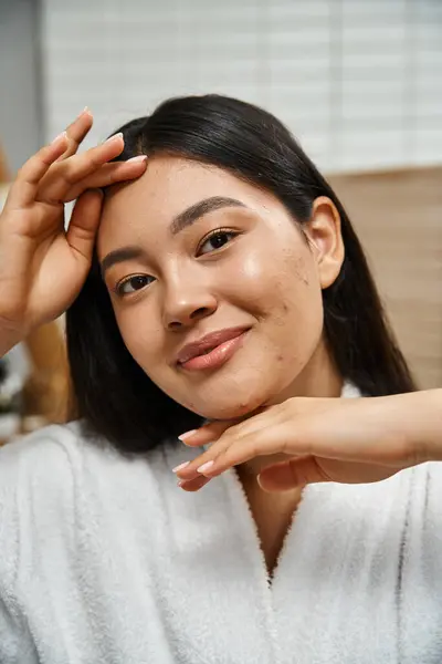 Ritratto di felice giovane donna asiatica con acne toccare il viso e guardando la fotocamera, la cura della pelle — Foto stock