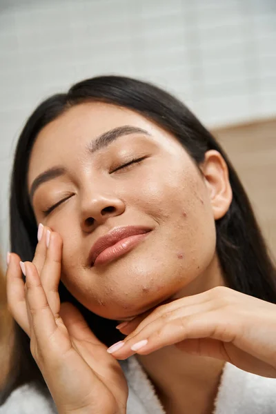 Retrato de jovem e asiática mulher com olhos fechados e acne tocando seu rosto, problemas de pele — Fotografia de Stock