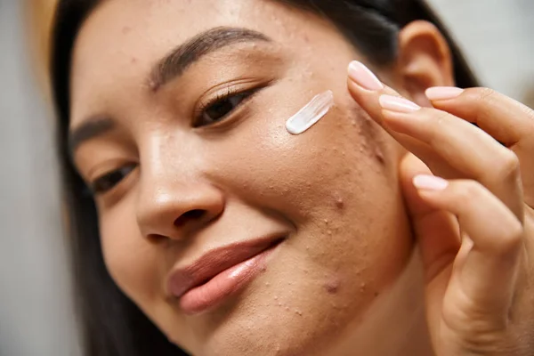 Primer plano disparo de joven mujer asiática con pelo morena aplicación de acné tratamiento crema en la cara - foto de stock