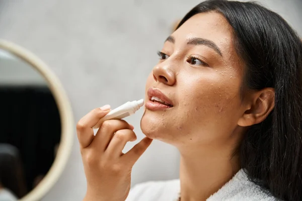 Jovem e morena mulher asiática com acne aplicando bálsamo labial e olhando para o espelho no banheiro — Fotografia de Stock